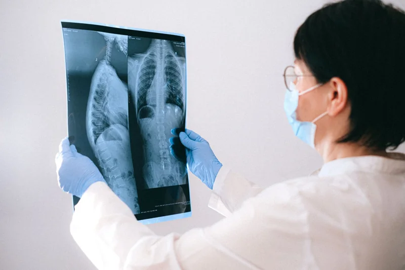 Illustrative photograph of a healthcare professional examining an X-ray.