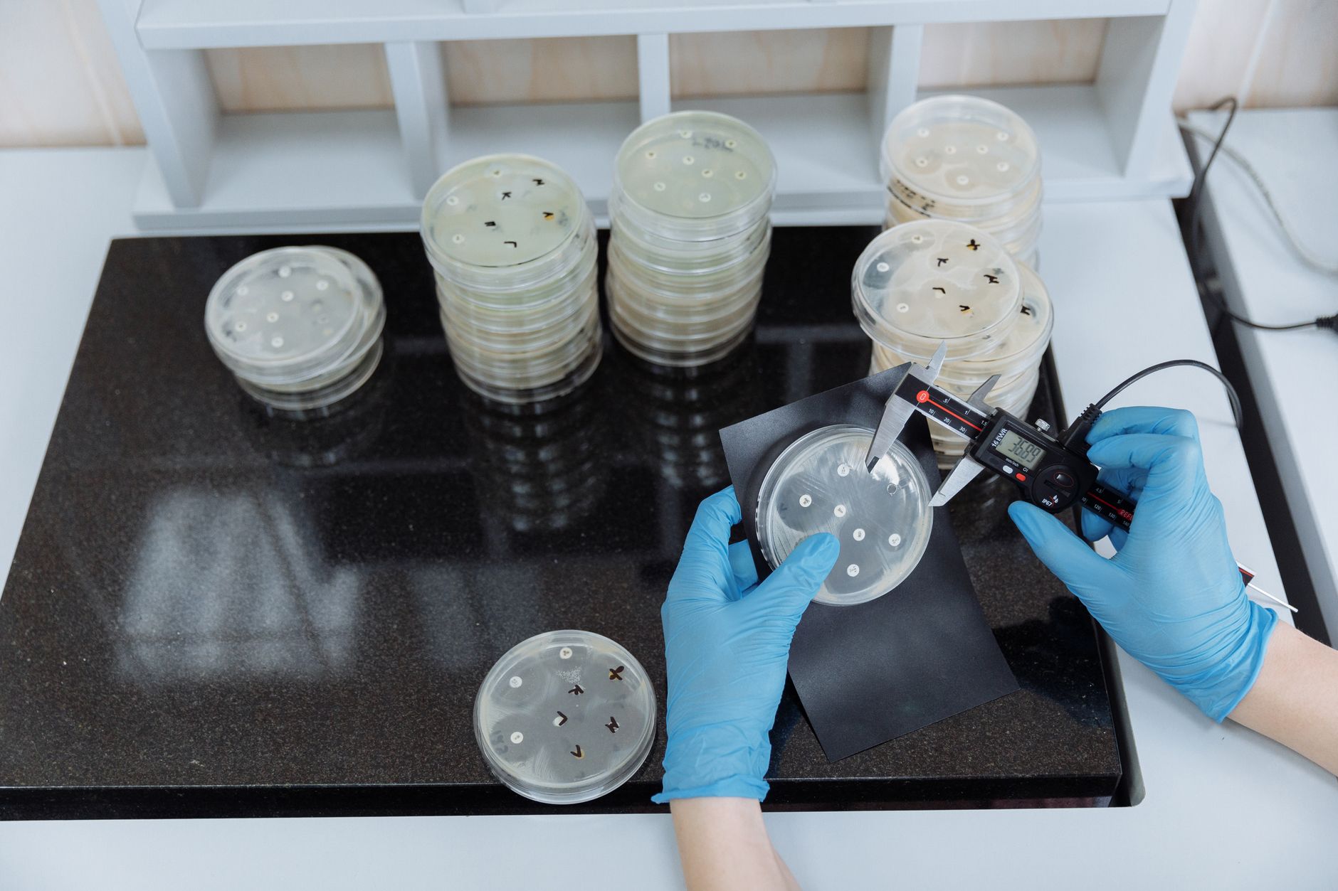 Scientist measuring bacteria growth in petri dishes under sterile lab conditions — Regenerative Medicine